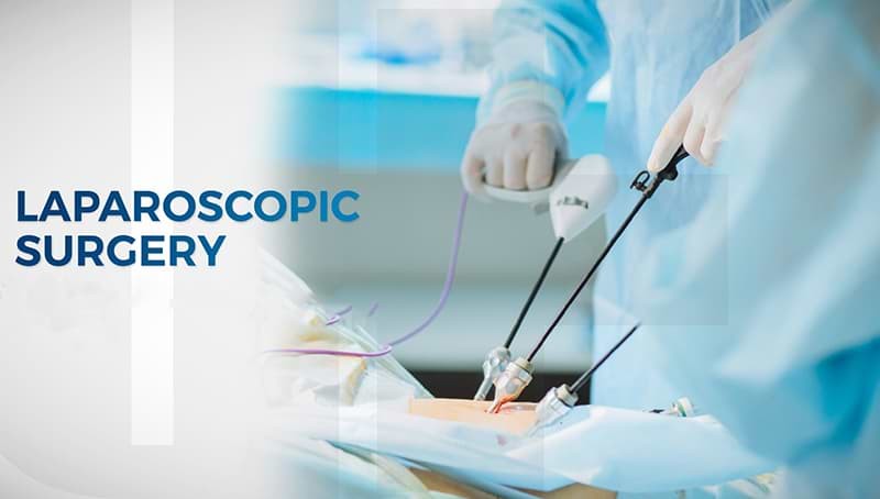 Laparoscopic Surgeries